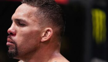 ufc-middleweight-eryk-anders-posts-gruesome-photos-after-apparent-chainsaw-jpg