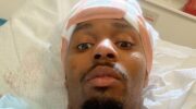 lerone-murphy-hospitalized-after-cycling-accident-another-near-death-experience-jpg