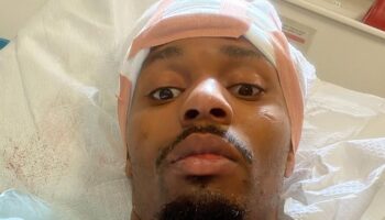 lerone-murphy-hospitalized-after-cycling-accident-another-near-death-experience-jpg
