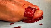 benoit-saint-denis-describes-the-horrific-toe-injury-sustained-at-ufc-jpg
