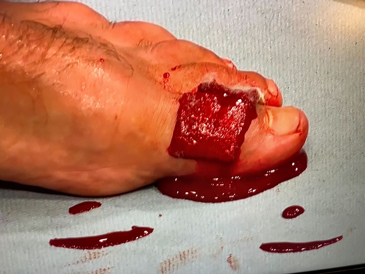 benoit-saint-denis-describes-the-horrific-toe-injury-sustained-at-ufc-jpg