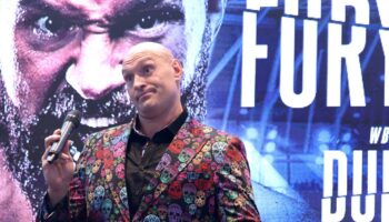 tyson-fury-who-explains-why-boxing-is-not-his-passion-jpg