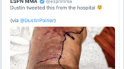 conor-mcgregor-pokes-fun-at-dustin-poiriers-staph-infection-deletes-png