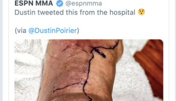 conor-mcgregor-pokes-fun-at-dustin-poiriers-staph-infection-deletes-png
