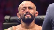 deiveson-figueiredo-undergoes-surgery-for-broken-orbital-nose-following-ufc-jpg