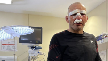 glover-teixeira-escapes-serious-injuries-during-ufc-283-conflict-with-png