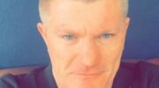 hatton-showed-a-terrible-photo-after-surgery-on-his-hand-jpg