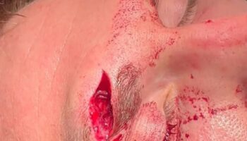 dana-white-questioned-stoppage-in-evan-elder-vs-nazim-sadykhov-jpg